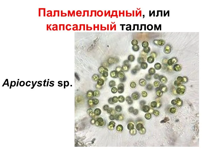 Пальмеллоидный, или капсальный таллом Apiocystis sp.
