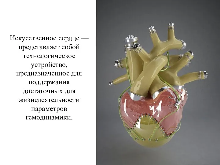 Искусственное сердце — представляет собой технологическое устройство, предназначенное для поддержания достаточных для жизнедеятельности параметров гемодинамики.