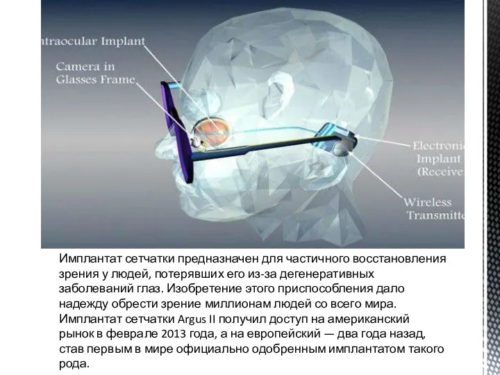 Имплантат сетчатки предназначен для частичного восстановления зрения у людей, потерявших его из-за