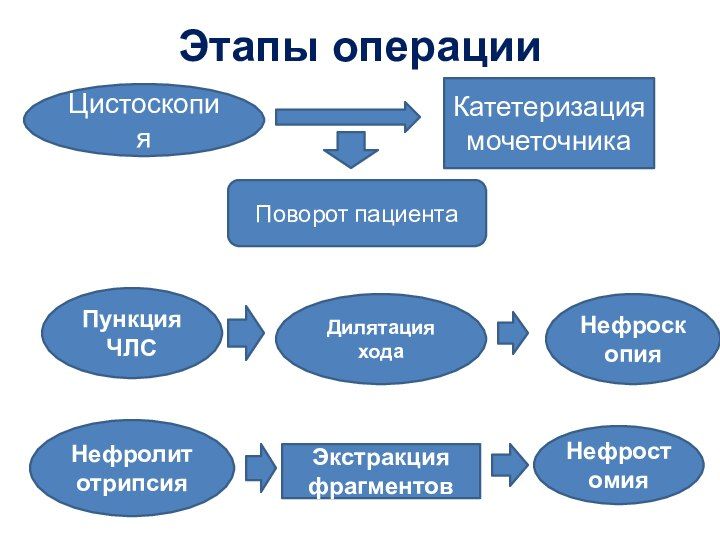 Где Можно Купить Литературу Про Перкутанную Нефролитотрипсию