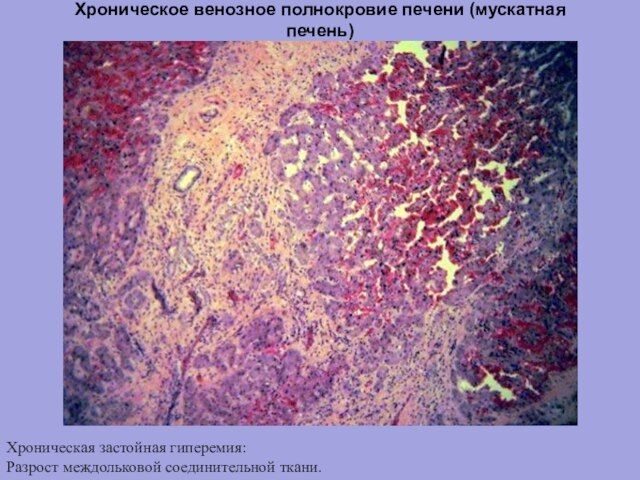 Мускатная Печень Фото