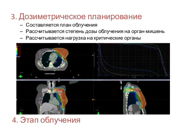 3. Дозиметрическое планирование Составляется план облучения Рассчитывается степень дозы облучения на орган-мишень