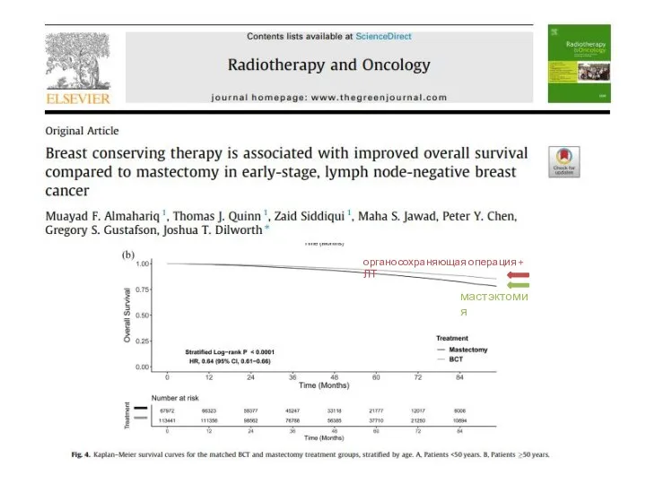 мастэктомия органосохраняющая операция + ЛТ