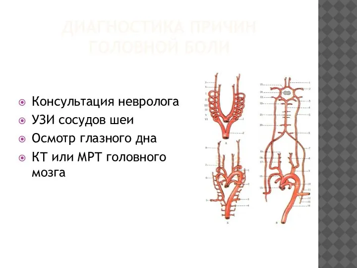 ДИАГНОСТИКА ПРИЧИН ГОЛОВНОЙ БОЛИ Консультация невролога УЗИ сосудов шеи Осмотр глазного дна