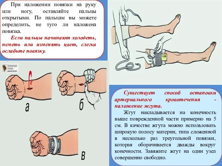 При наложении повязки на руку или ногу, оставляйте пальцы открытыми. По пальцам