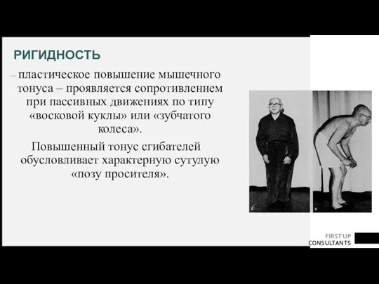 РИГИДНОСТЬ – пластическое повышение мышечного тонуса – проявляется сопротивлением при пассивных движениях