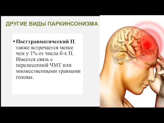 ДРУГИЕ ВИДЫ ПАРКИНСОНИЗМА Посттравматический П. также встречается менее чем у 1% от