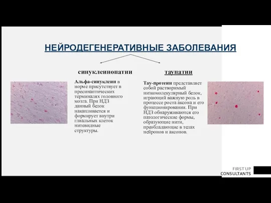 НЕЙРОДЕГЕНЕРАТИВНЫЕ ЗАБОЛЕВАНИЯ синуклеинопатии таупатии Альфа-синуклеин в норме присутствует в пресинаптических терминалях головного