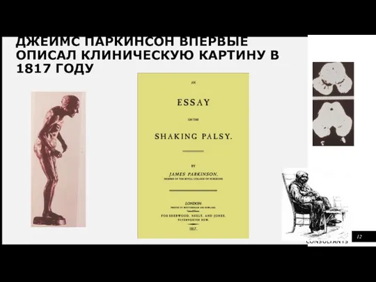 ДЖЕЙМС ПАРКИНСОН ВПЕРВЫЕ ОПИСАЛ КЛИНИЧЕСКУЮ КАРТИНУ В 1817 ГОДУ 12