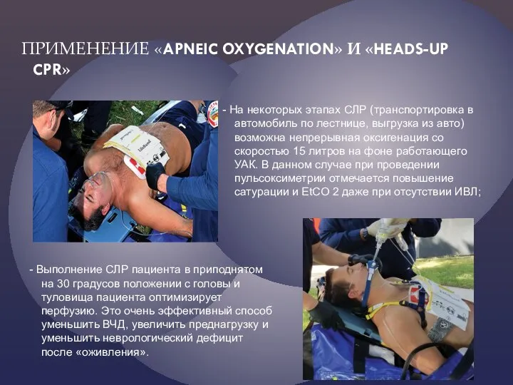 ПРИМЕНЕНИЕ «APNEIC OXYGENATION» И «HEADS-UP CPR» - На некоторых этапах СЛР (транспортировка