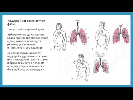 Кашлевой акт включает три фазы : 1)Короткий и глубокий вдох 2)Напряжение дыхательных