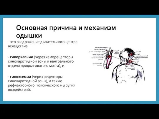 Основная причина и механизм одышки - это раздражение дыхательного центра вследствие -