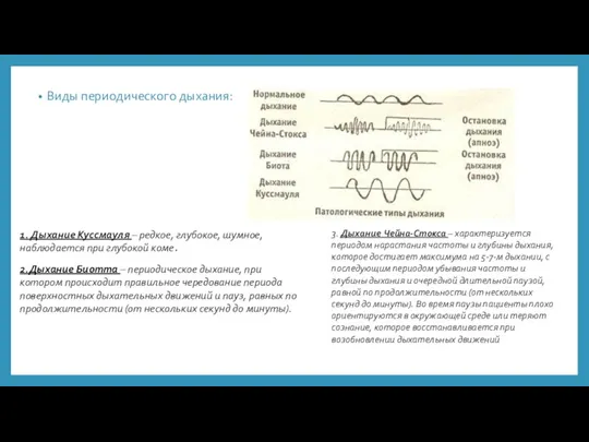 Виды периодического дыхания: 1. Дыхание Куссмауля – редкое, глубокое, шумное, наблюдается при