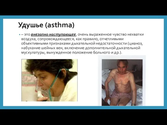 Удушье (asthma) – это внезапно наступающее, очень выраженное чувство нехватки воздуха, сопровождающееся,