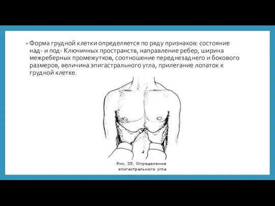 Форма грудной клетки определяется по ряду признаков: состояние над- и под- Ключичных