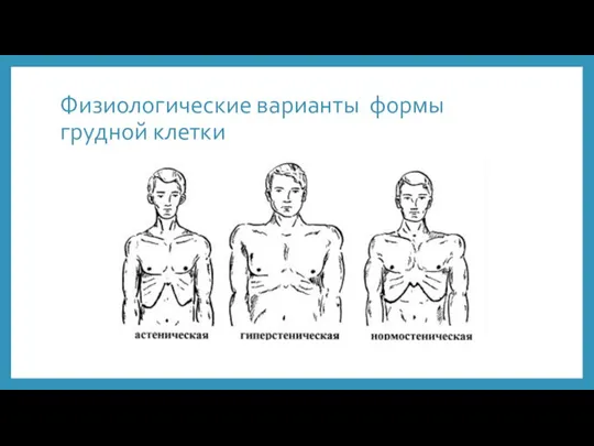 Физиологические варианты формы грудной клетки