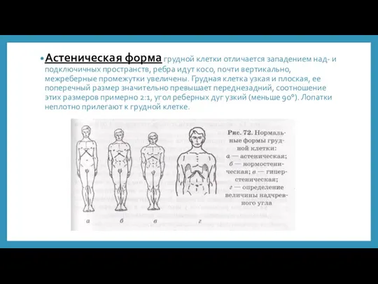 Астеническая форма грудной клетки отличается западением над- и подключичных пространств, ребра идут