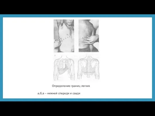Определение границ легких а,б,в – нижней спереди и сзади