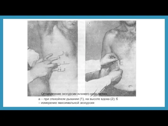 а – при спокойном дыхании (1), на высоте вдоха (2); б – измерение максимальной экскурсии