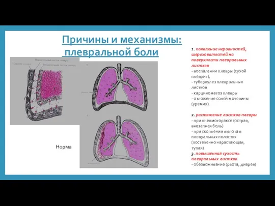 Причины и механизмы: плевральной боли Норма 1. появление неровностей, шероховатостей на поверхности