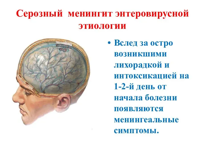 Серозный менингит энтеровирусной этиологии Вслед за остро возникшими лихорадкой и интоксикацией на