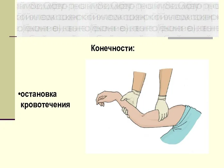 Конечности: остановка кровотечения