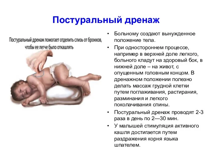 Постуральный дренаж Больному создают вынужденное положение тела. При одностороннем процессе, например в