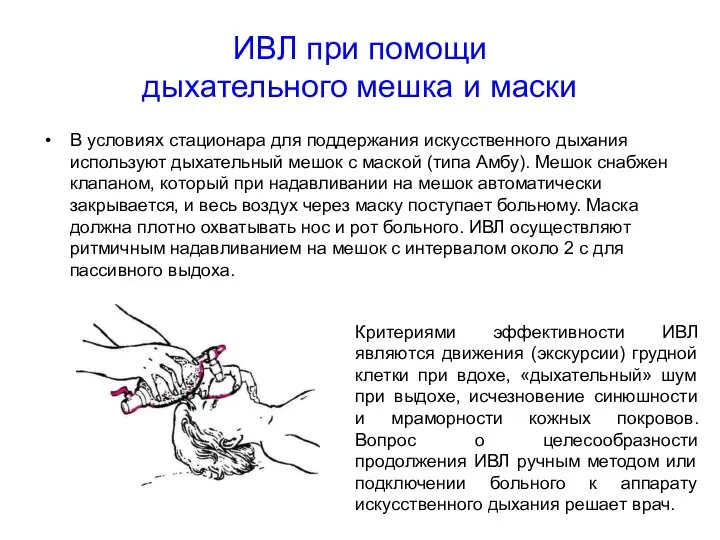 ИВЛ при помощи дыхательного мешка и маски В условиях стационара для поддержания