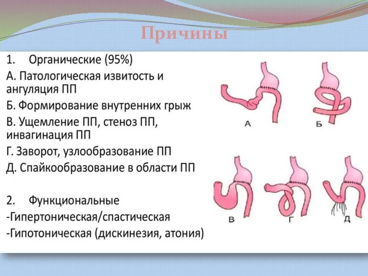 Причины