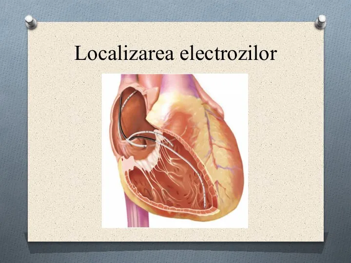 Localizarea electrozilor