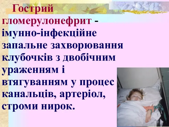 Гострий гломерулонефрит - імунно-інфекційне запальне захворювання клубочків з двобічним ураженням і втягуванням