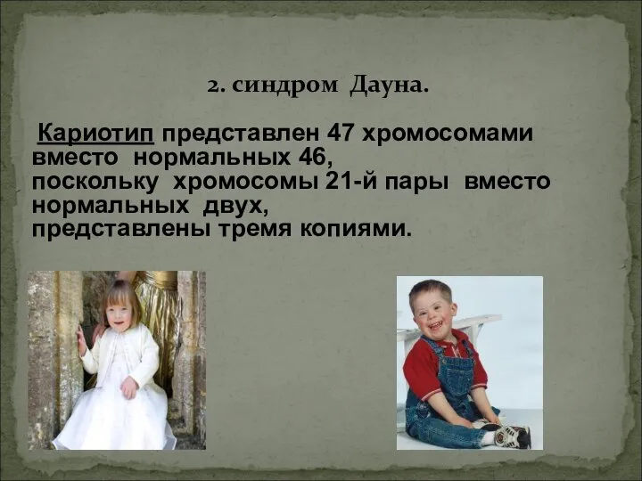 2. синдром Дауна. Кариотип представлен 47 хромосомами вместо нормальных 46, поскольку хромосомы