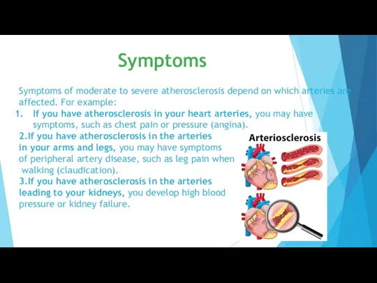Symptoms of moderate to severe atherosclerosis depend on which arteries are affected.