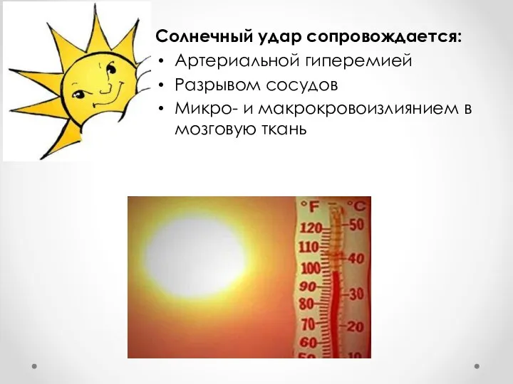 Солнечный удар сопровождается: Артериальной гиперемией Разрывом сосудов Микро- и макрокровоизлиянием в мозговую ткань