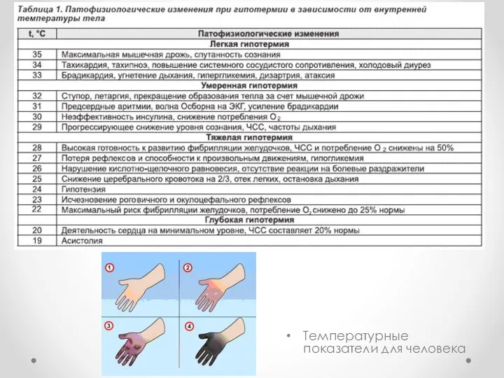 Температурные показатели для человека