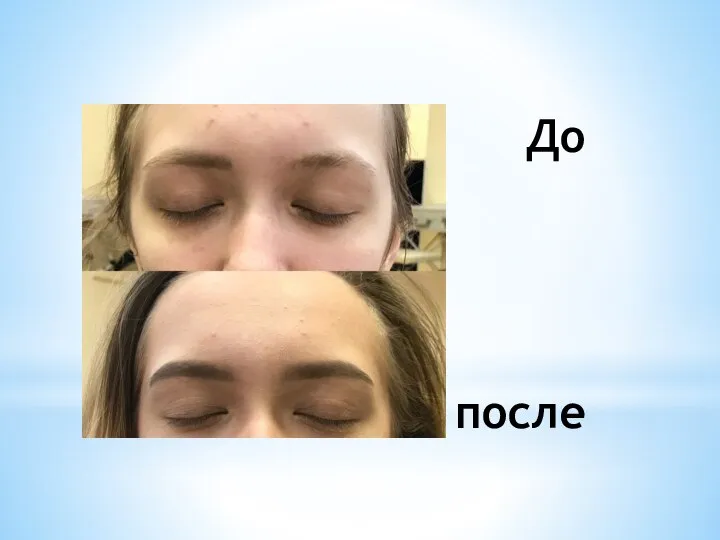 До после