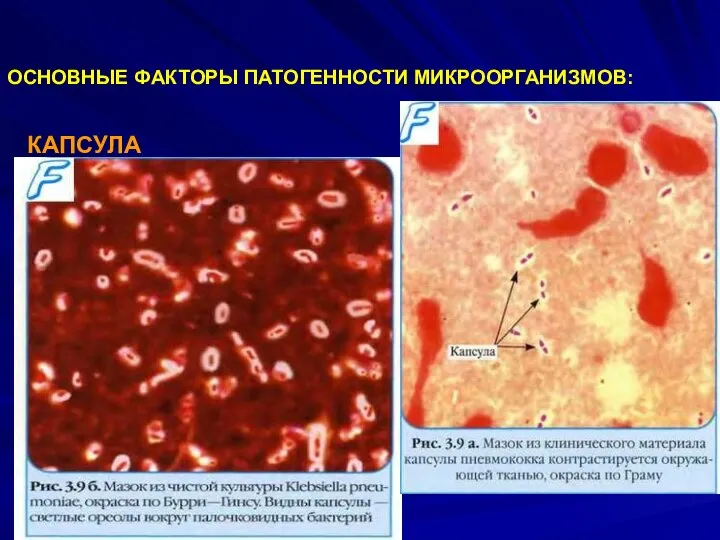 ОСНОВНЫЕ ФАКТОРЫ ПАТОГЕННОСТИ МИКРООРГАНИЗМОВ: КАПСУЛА