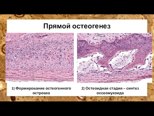 Прямой остеогенез 1) Формирование остеогенного островка 2) Остеоидная стадия – синтез оссеомукоида