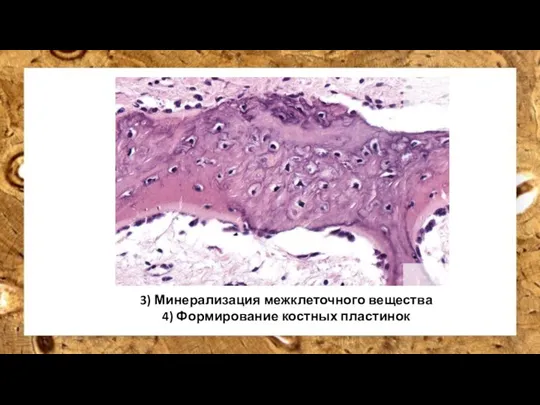 3) Минерализация межклеточного вещества 4) Формирование костных пластинок