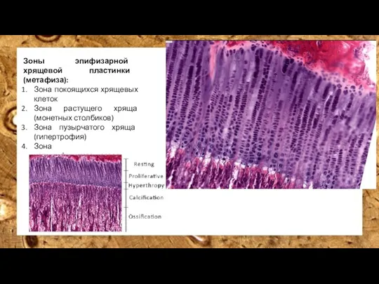 Зоны эпифизарной хрящевой пластинки (метафиза): Зона покоящихся хрящевых клеток Зона растущего хряща
