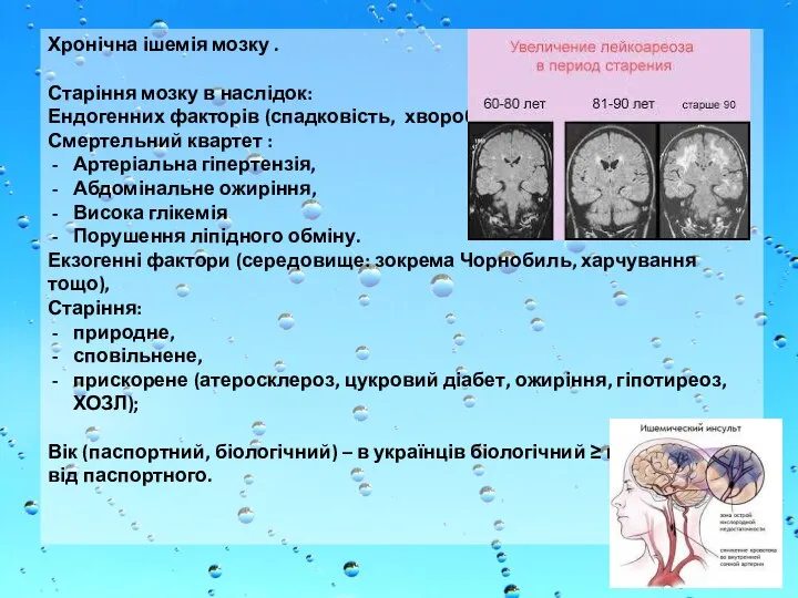 Хронічна ішемія мозку . Старіння мозку в наслідок: Ендогенних факторів (спадковість, хвороби),