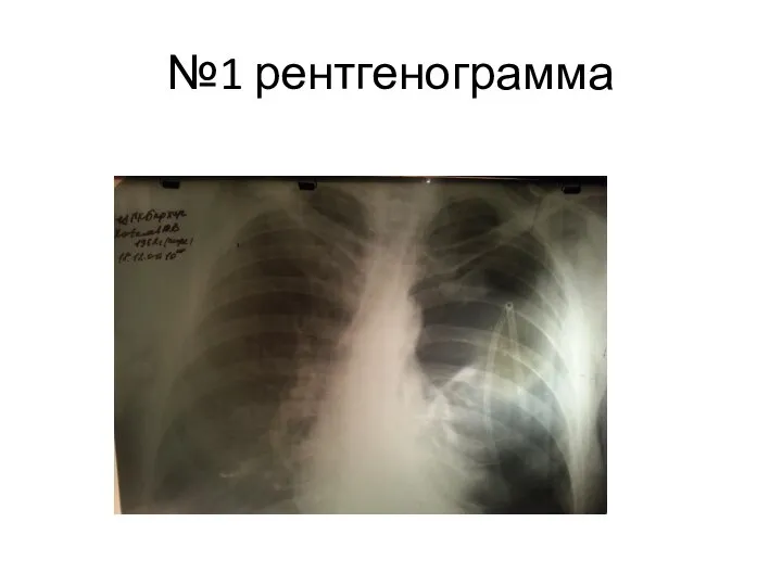 №1 рентгенограмма