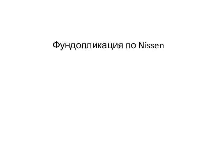 Фундопликация по Nissen