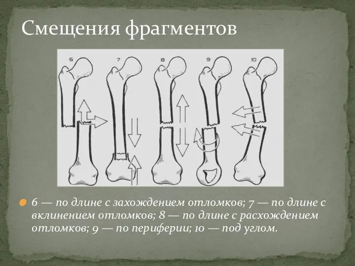 Смещения фрагментов 6 — по длине с захождением отломков; 7 — по