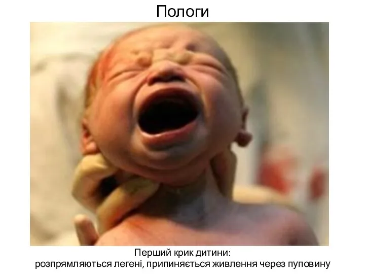 Пологи Перший крик дитини: розпрямляються легені, припиняється живлення через пуповину