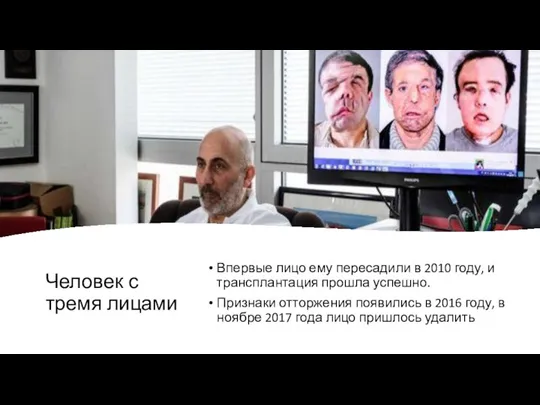 Человек с тремя лицами Впервые лицо ему пересадили в 2010 году, и