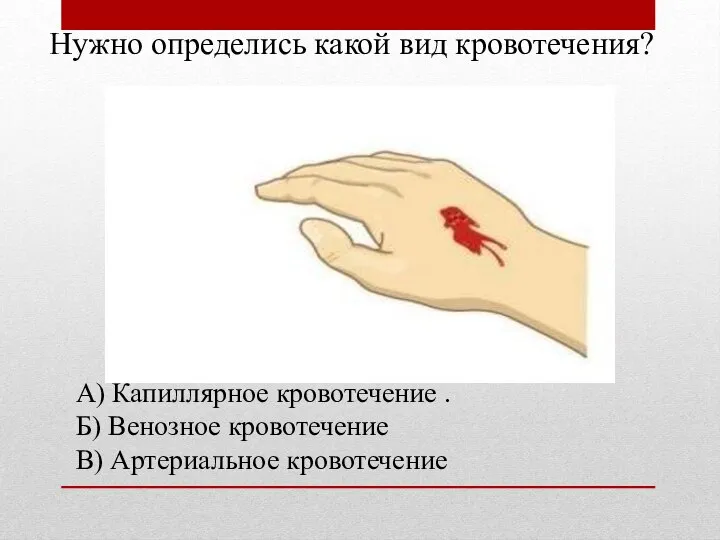 Нужно определись какой вид кровотечения? А) Капиллярное кровотечение . Б) Венозное кровотечение В) Артериальное кровотечение