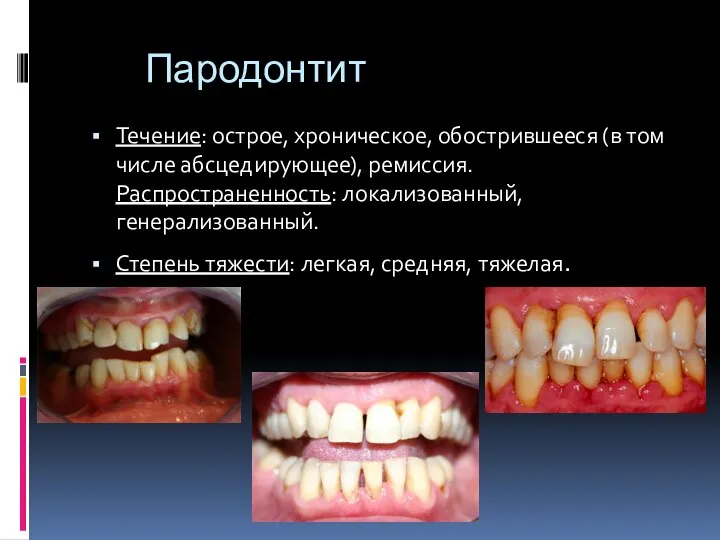 Пародонтит Течение: острое, хроническое, обострившееся (в том числе абсцедирующее), ремиссия. Распространенность: локализованный,