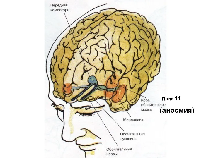 Поле 11 (аносмия)