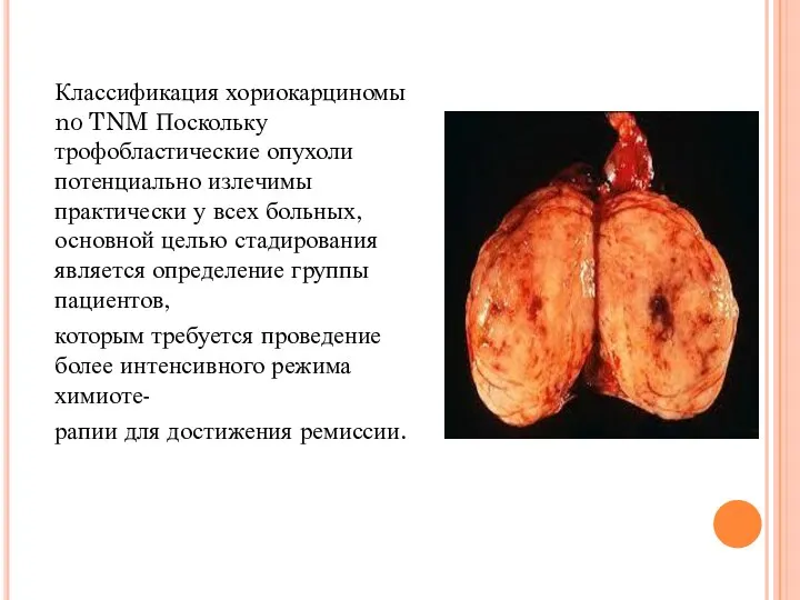 Классификация хориокарциномы no TNM Поскольку трофобластические опухоли потенциально излечимы практически у всех